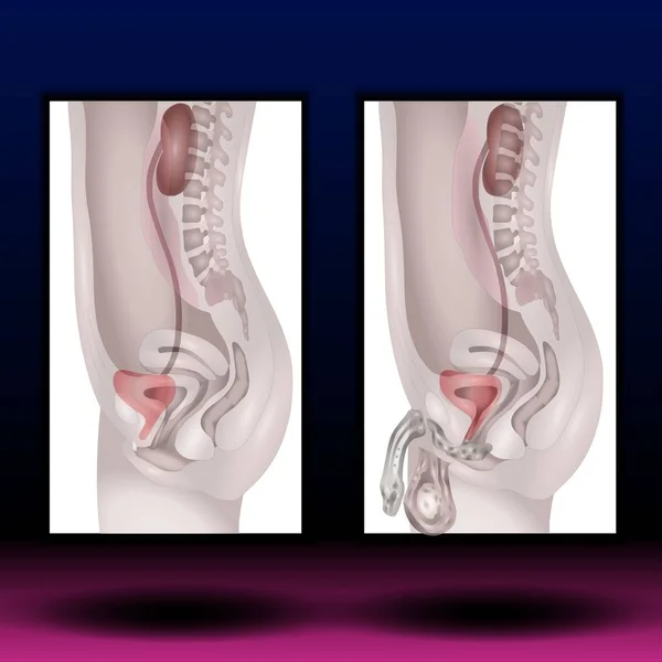 İdrar Sistemi Erkeği ve Kadın - Kadın Kaynak Dosyası - Erkek ve Kadın Üreme Sistemi. Vektör çizimi. İnsan anatomisi.