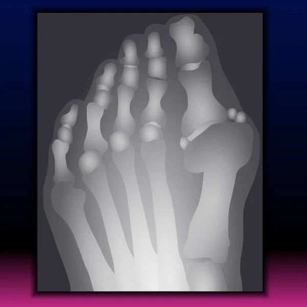 Рентгеновский Снимок Ноги Исходный Файл Fla Доступен — стоковое фото