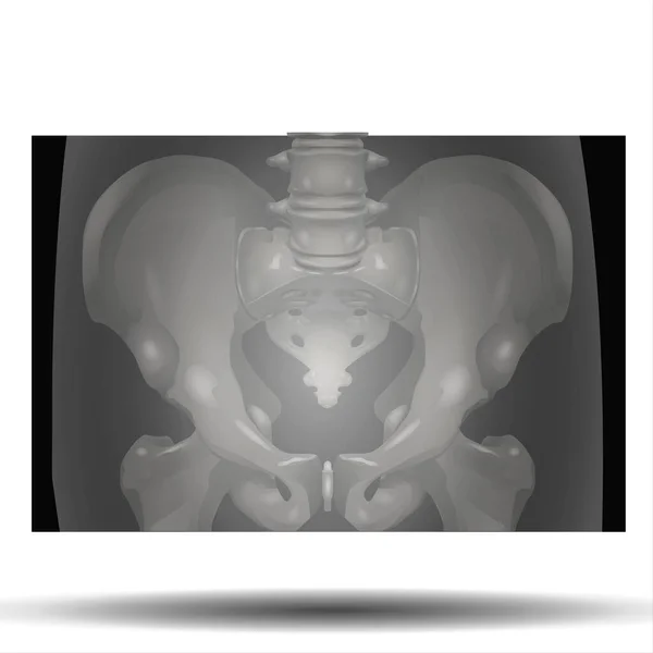 X-Ray of Pelvis - Fla source file available - Structure of the pelvis. Anatomical poster of human skeleton. Pelvic bones concept. Sacrum, Ischium, pubis and ilium. Coccyx and pubic symphysis in male body. Medical vector illustration. X ray image.