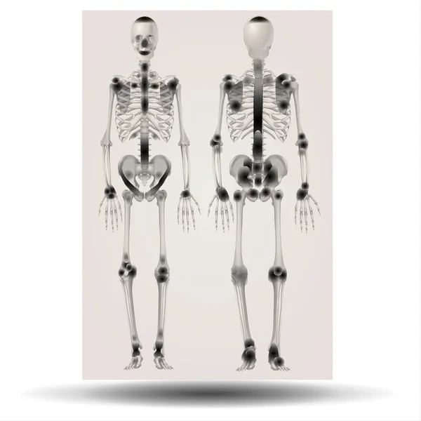 Ray Illustration Human Skeleton Fla Source File Available Ray Illustration — Stock Photo, Image