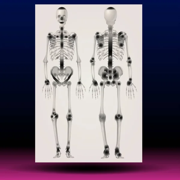 Ray Illustration Human Skeleton Fla Source File Available Ray Illustration — Stock Photo, Image