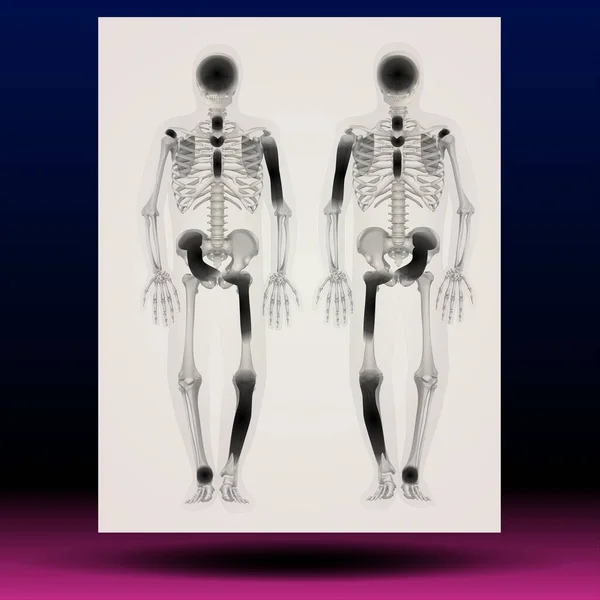 Bir insan iskeletinin X-ray çizimi - Fla kaynak dosyası mevcut - bir insan iskeletinin X-ray çizimi
