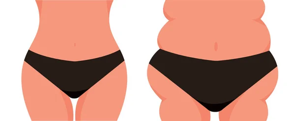 Weight Loss Concept Body Overweight Slender Body Woman Underwear Close — Stockvektor