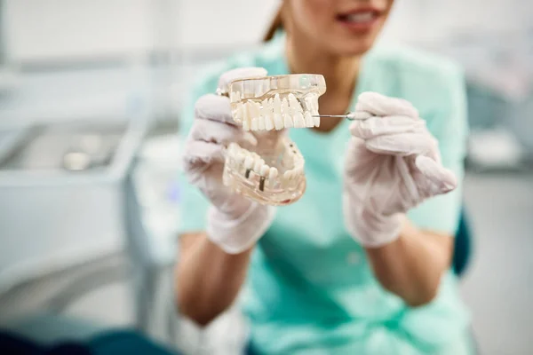 Close-up of orthodontist showing dental prosthetic with one dental implant at dentist\'s office.