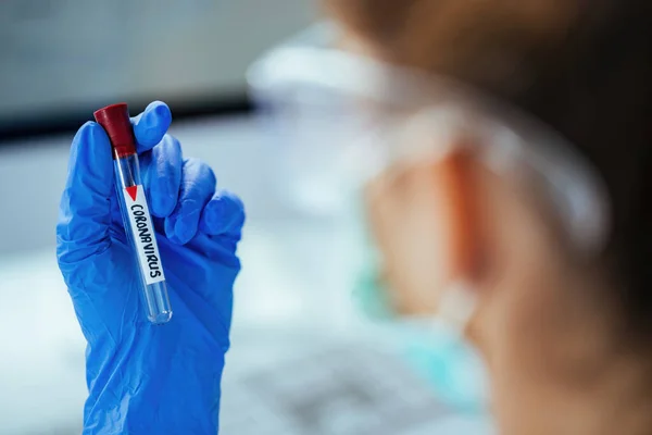 Close Medical Technician Holding Test Tube Coronavirus While Working Laboratory — Fotografia de Stock