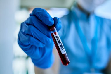 Close-up of epidemiologist with coronavirus blood sample in specimen holder.
