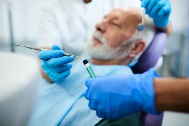 Close-up of dentist and his assistant preparing for dental filling procedure while working senior patient's teeth. 
