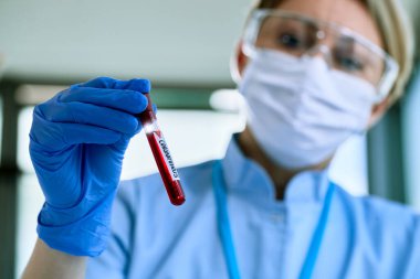 Close-up of doctor with blood sample infected with coronavirus. 