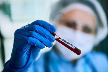 Close-up of doctor holding blood sample infected with corona virus.