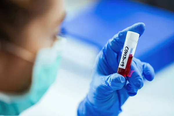 Close Laboratory Technician Coronavirus Blood Test Sample — Fotografia de Stock