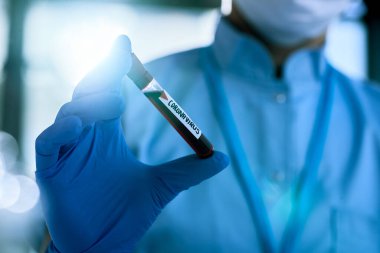 Close-up of epidemiologist with coronavirus blood sample in specimen holder.