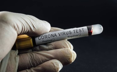 Close up of Corona virus lab test tube. Doctor wearing gloves holding a Covid-19 blood test sample. Pandemia prevention, medical healthcare and treatment concept, black background.