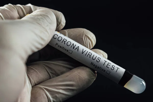 Close up of Corona virus lab test tube. Doctor wearing gloves holding a Covid-19 blood test sample. Pandemia prevention, medical healthcare and treatment concept, black background.