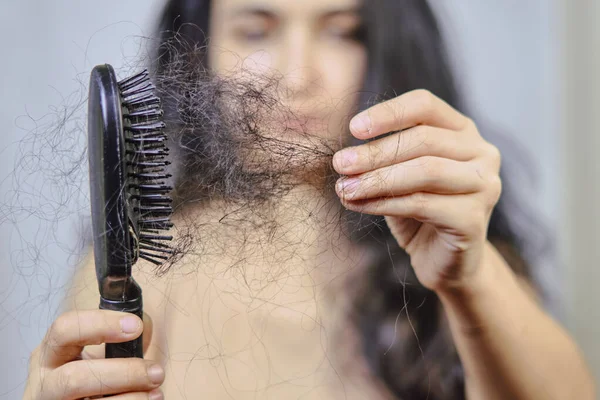 女性脱发 一个有脱发问题的可悲的年轻女人 头发损失的问题 严重脱发的妇女接受保健护理 — 图库照片