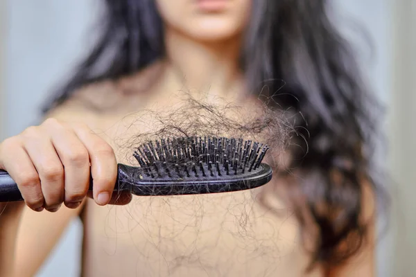 女性の脱毛 脱毛の問題を持つ悲しい若い女性 脱毛の問題 健康管理のための深刻な脱毛の問題を持つ女性 — ストック写真