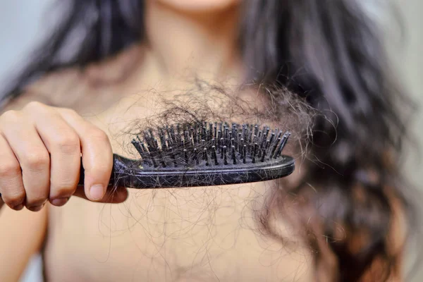 女性脱发 一个有脱发问题的可悲的年轻女人 头发损失的问题 严重脱发的妇女接受保健护理 — 图库照片