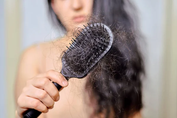 女性の脱毛 脱毛の問題を持つ悲しい若い女性 脱毛の問題 健康管理のための深刻な脱毛の問題を持つ女性 — ストック写真