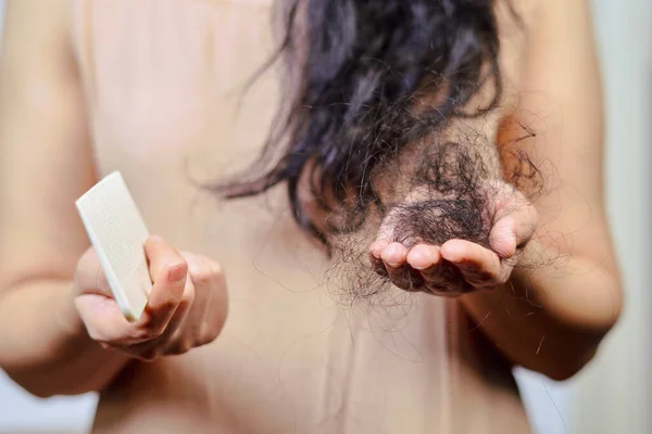 Weiblicher Haarausfall Traurige Junge Frau Mit Haarausfall Problem Haarausfall Probleme lizenzfreie Stockfotos