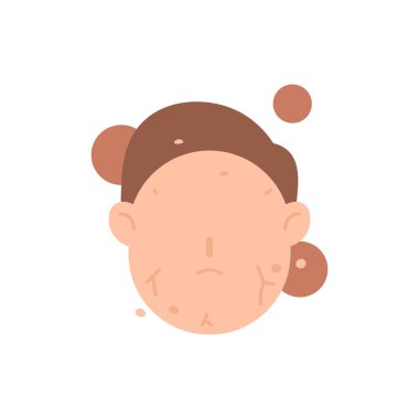Xerosis, a dry and peeling skin condition. the skin on the face is scaly and dry. lack of moisture in the skin and lack of water content. health. flat cartoon illustration. vector concept design