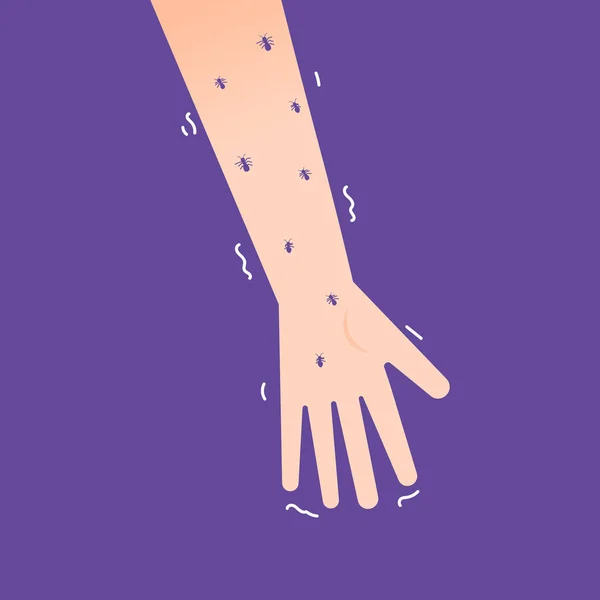 Uma Mão Repleta Formigas Sintomas Formigueiro Parestesias Tremores Aperto Mão — Vetor de Stock
