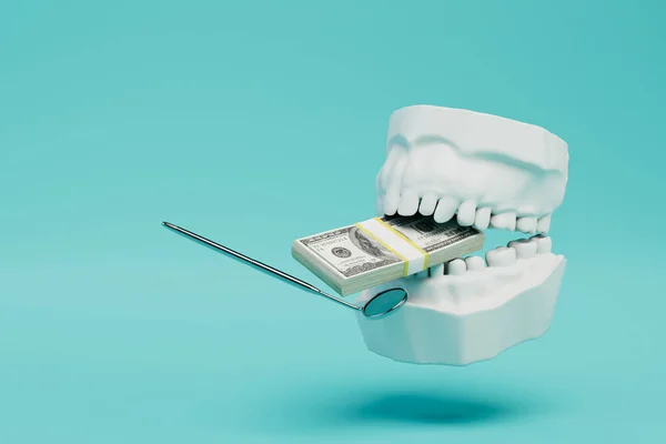 Teure Behandlung Beim Zahnarzt Kiefermodell Mit Einem Stapel Dollars Zwischen — Stockfoto