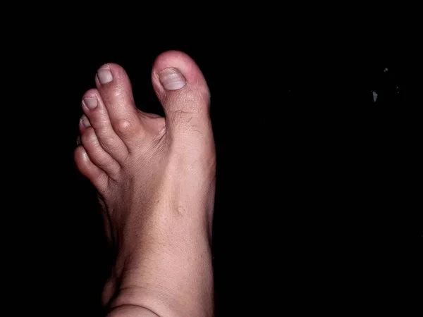 The toes of a man with light brown skin are visible in the dark night
