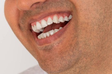 Close up photo of brown skinned young adult man with gum smiling. White teeth concept.