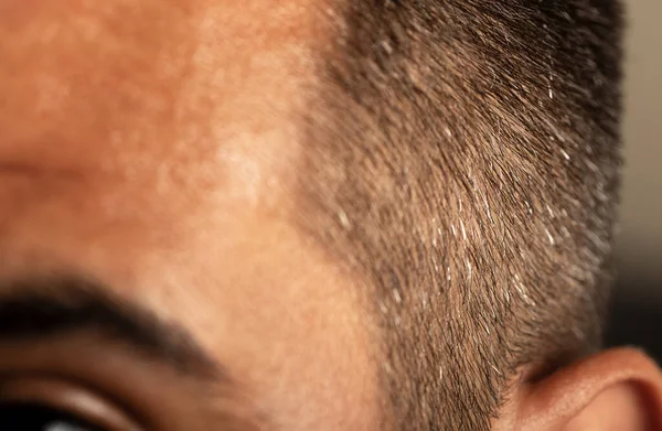 Close Photo Young Adult Man Grey Hair Side His Head — Stok fotoğraf