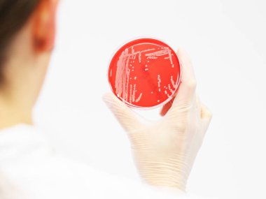 Bakterienkolonien auf einer Agarplatte in einer Hand