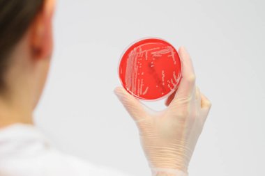 Bakterienkolonien auf einer Agarplatte in einer Hand