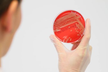 Bakterienkolonien auf einer Agarplatte in einer Hand