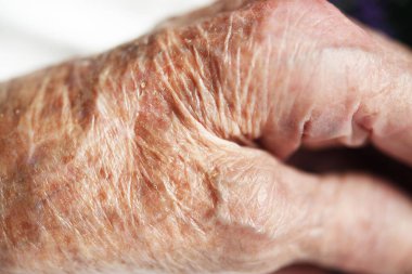 Hand of old 90 year old woman grandmother.