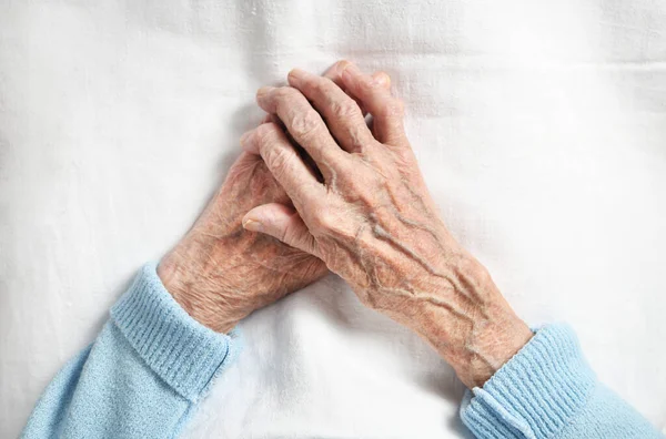 白地に90歳の老女の手の関節リウマチ — ストック写真