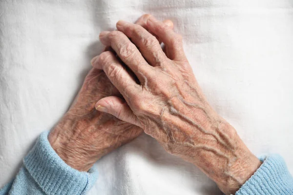 Rheumatoid arthritis of the hands of an elderly 90 year old woman on a white background.