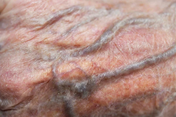 Close Vein Skin Senior Year Old Man Wrinkled Skin White — Stock Photo, Image