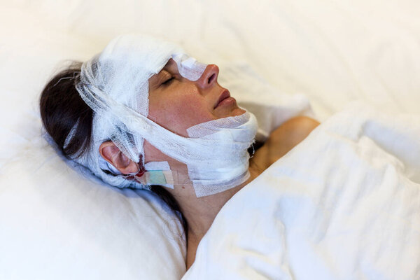 A girl after surgery with a bandaged head lies on the bed. Head trauma, concussion, injured in a car catastrophe