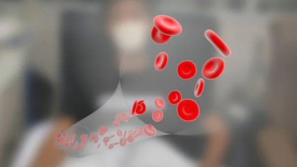Los Glóbulos Rojos Fluyen Brazo Donante Recolector Sangre Proceso Donación — Foto de Stock