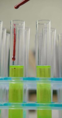 Bağışıklık bilimi alanındaki araştırmalar enfekte olmuş kan damlalarının araştırma için bir çözümü olan bir test tüpüne döküldüğünü gösteriyor. Dikey video.