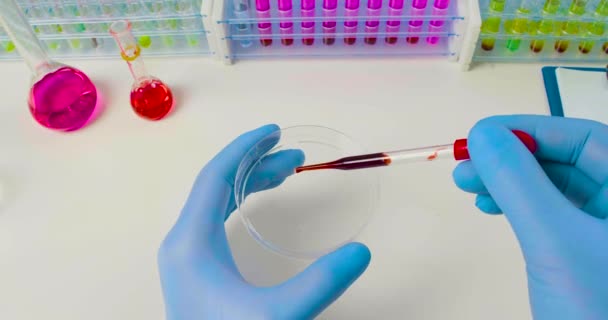 Video 4k close-up - Lékař kape vzorek infikované krve do Petriho misky pro výzkum. — Stock video