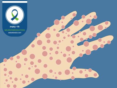 Neurofibromatosis , tumors to grow on nerves