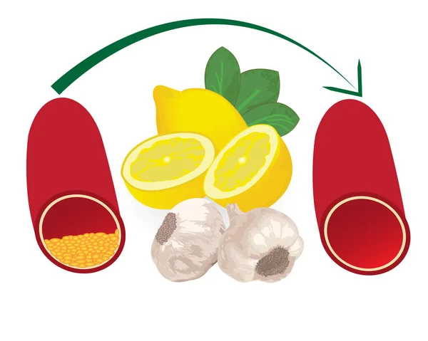 Convirtiendo el alto nivel de placa aterosclerótica en los vasos sanguíneos en un nivel normal con una comida saludable como el limón y el ajo — Archivo Imágenes Vectoriales