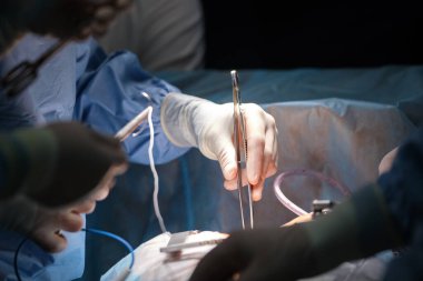 Cerrahi odasındaki açık kalp ameliyatı sırasında bir hastayı ameliyat eden profesyonel doktorların yakınlaşması. Sağlık ve tıbbi müdahale kavramı.