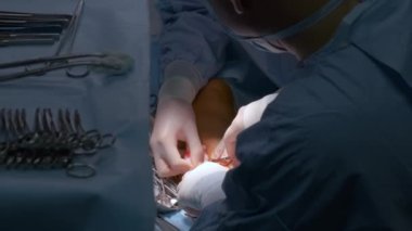 Cerrahi odasında açık ameliyat yapan bir hastayı ameliyat eden doktorların elleri. Sağlık ve tıbbi müdahale kavramı