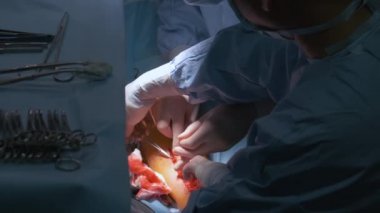 Cerrahi odasında açık ameliyat yapan bir hastayı ameliyat eden doktorların elleri. Sağlık ve tıbbi müdahale kavramı