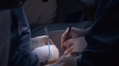 Profesyonel doktorlardan oluşan bir ekip ameliyathanede açık kalp ameliyatı yapan bir hastayı ameliyat ediyor. Sağlık ve tıbbi müdahale kavramı