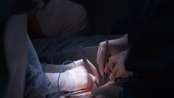 Крупный план профессиональных рук врача, оперирующих пациента во время операции на открытом сердце в хирургическом кабинете. Концепция здравоохранения и медицинского вмешательства — стоковое видео