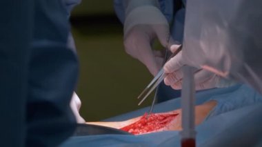 Cerrahi odasında açık ameliyat yapan bir hastayı ameliyat eden doktorların elleri. Sağlık ve tıbbi müdahale kavramı