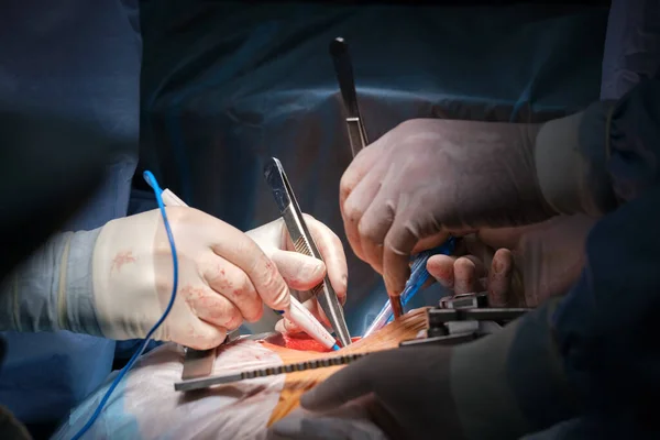 Closeup de mãos de médico profissional operando um paciente durante a cirurgia cardíaca aberta na sala cirúrgica. Conceito de cuidados de saúde e intervenção médica — Fotografia de Stock