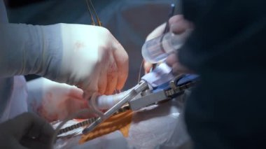 Cerrahi odasındaki açık kalp ameliyatı sırasında bir hastayı ameliyat eden profesyonel doktorların yakınlaşması. Sağlık ve tıbbi müdahale kavramı