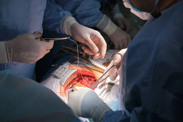 Cerrahi odasındaki açık kalp ameliyatı sırasında bir hastayı ameliyat eden profesyonel doktorların yakınlaşması. Sağlık ve tıbbi müdahale kavramı — Stok fotoğraf
